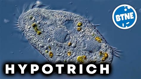  Heterotrichous ciliate! An Underwater Acrobat Performing Microscopic Ballet