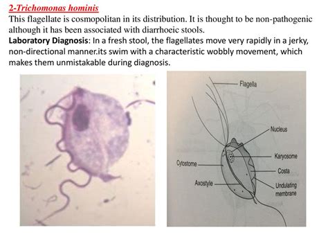 Leptomonas! Den mystiska flagellaten som simmar och sväljer sin väg genom världen.