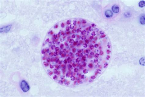 Toxoplasma gondii - En mikroskopisk parasit som invaderar hjärnan och manipulerar beteenden hos sina värdar!